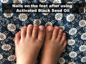 Nesil Chan Activated Black Seed Oil